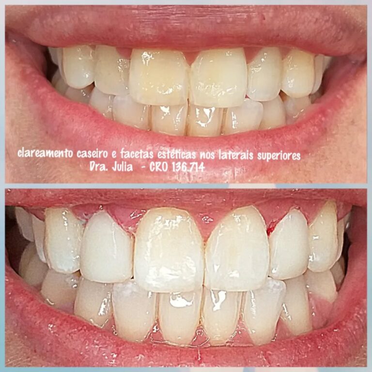 Instagram post from odonto_prime016. This post is in position 3.