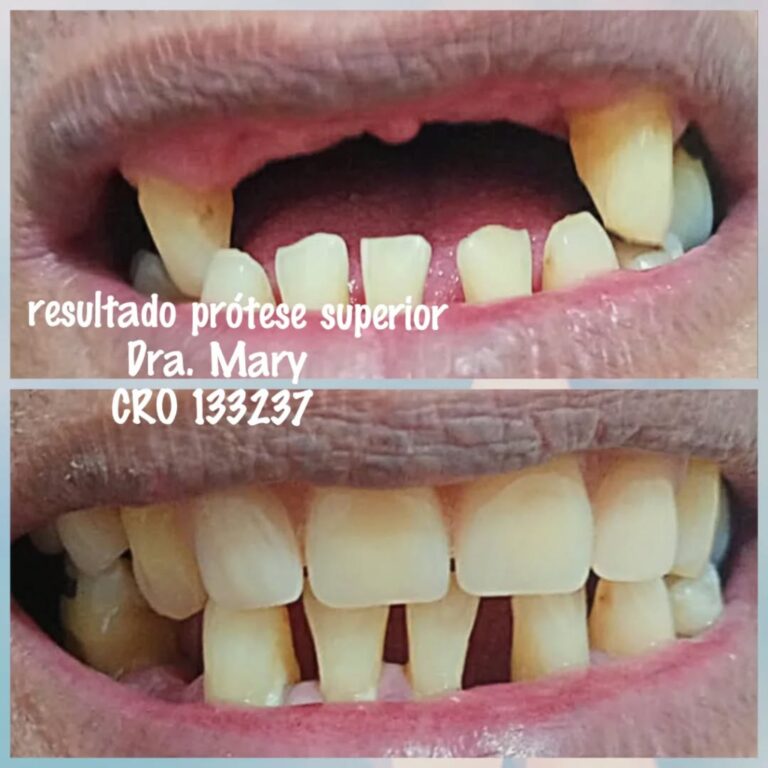 Instagram post from odonto_prime016. This post is in position 6.