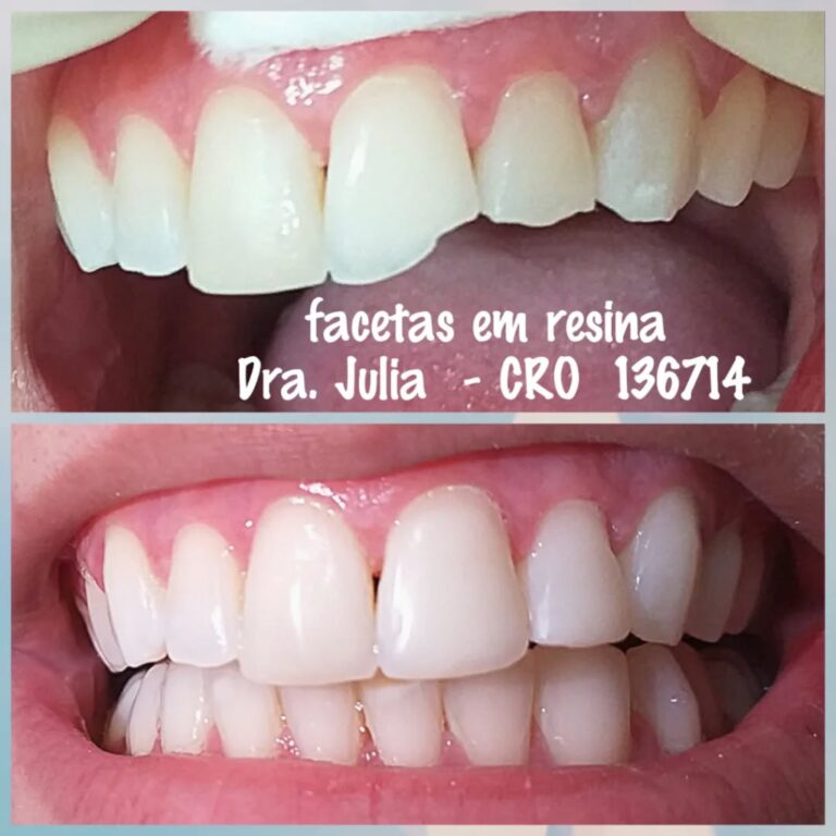 Instagram post from odonto_prime016. This post is in position 1.