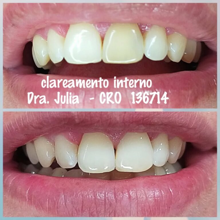 Instagram post from odonto_prime016. This post is in position 2.