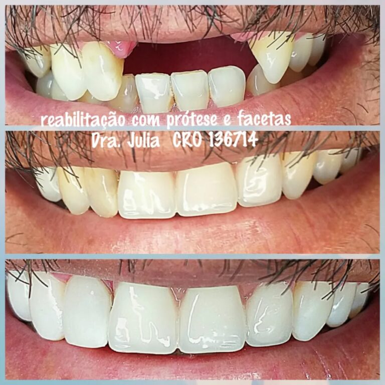 Instagram post from odonto_prime016. This post is in position 5.