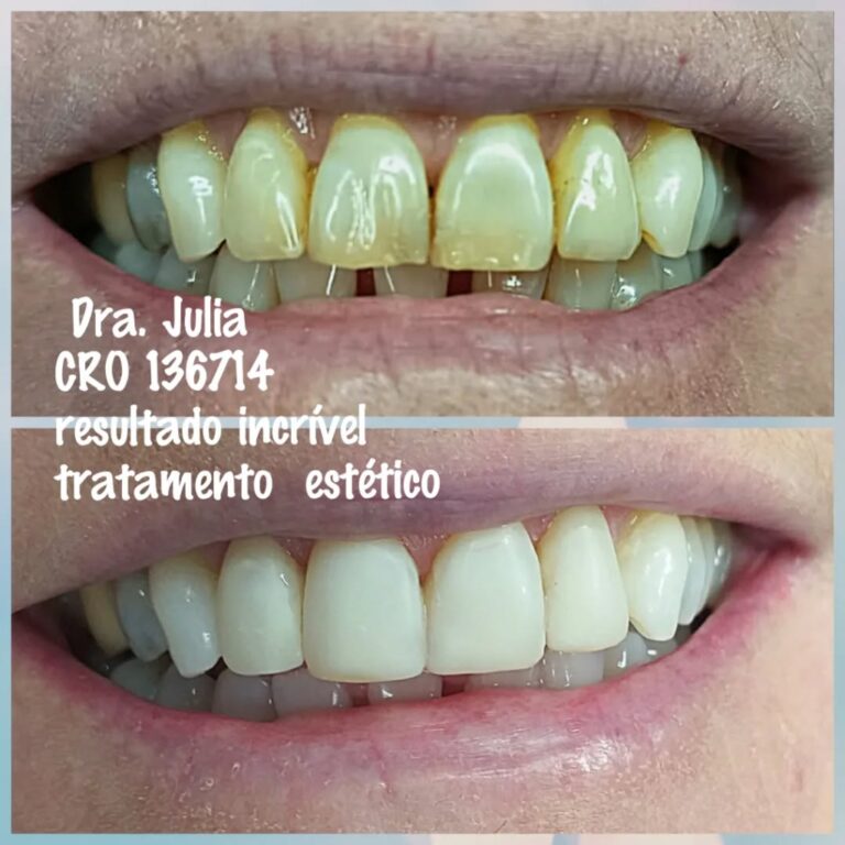 Instagram post from odonto_prime016. This post is in position 4.