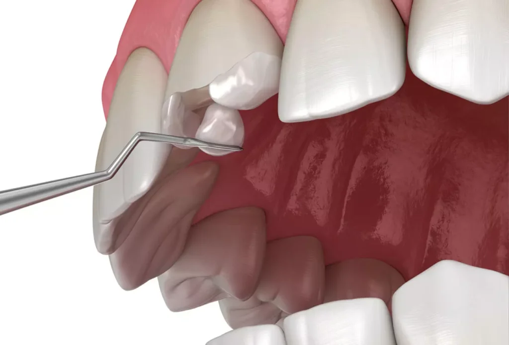AnyConv.com dente conserto